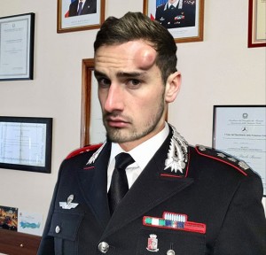 Carabiniere con bernoccolo